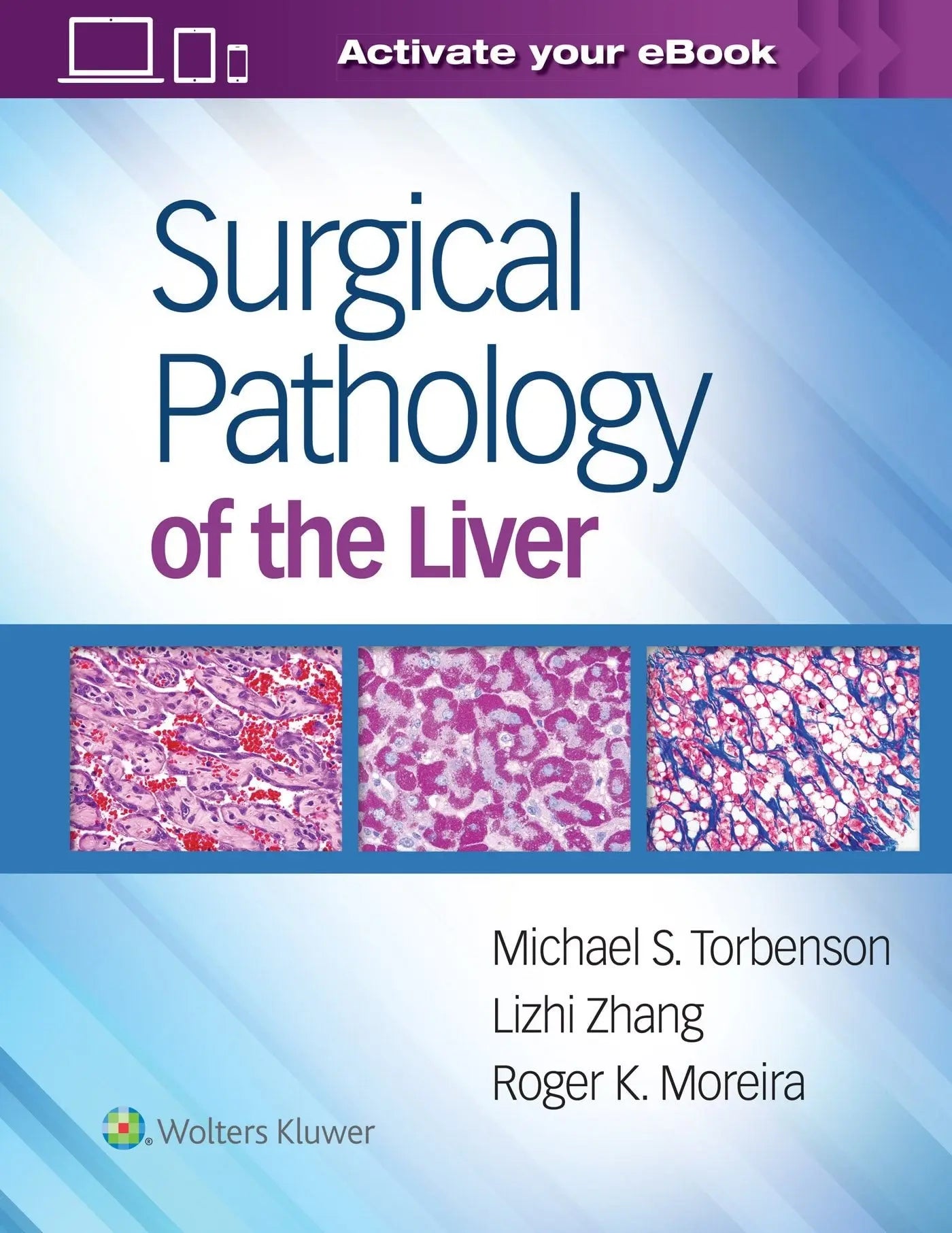 Surgical Pathology of the Liver by Michael S. Torbenson – book cover