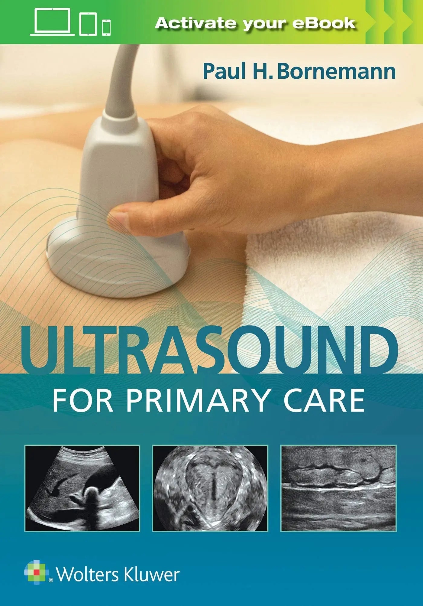 Ultrasound for Primary Care by Paul Bornemann – book cover