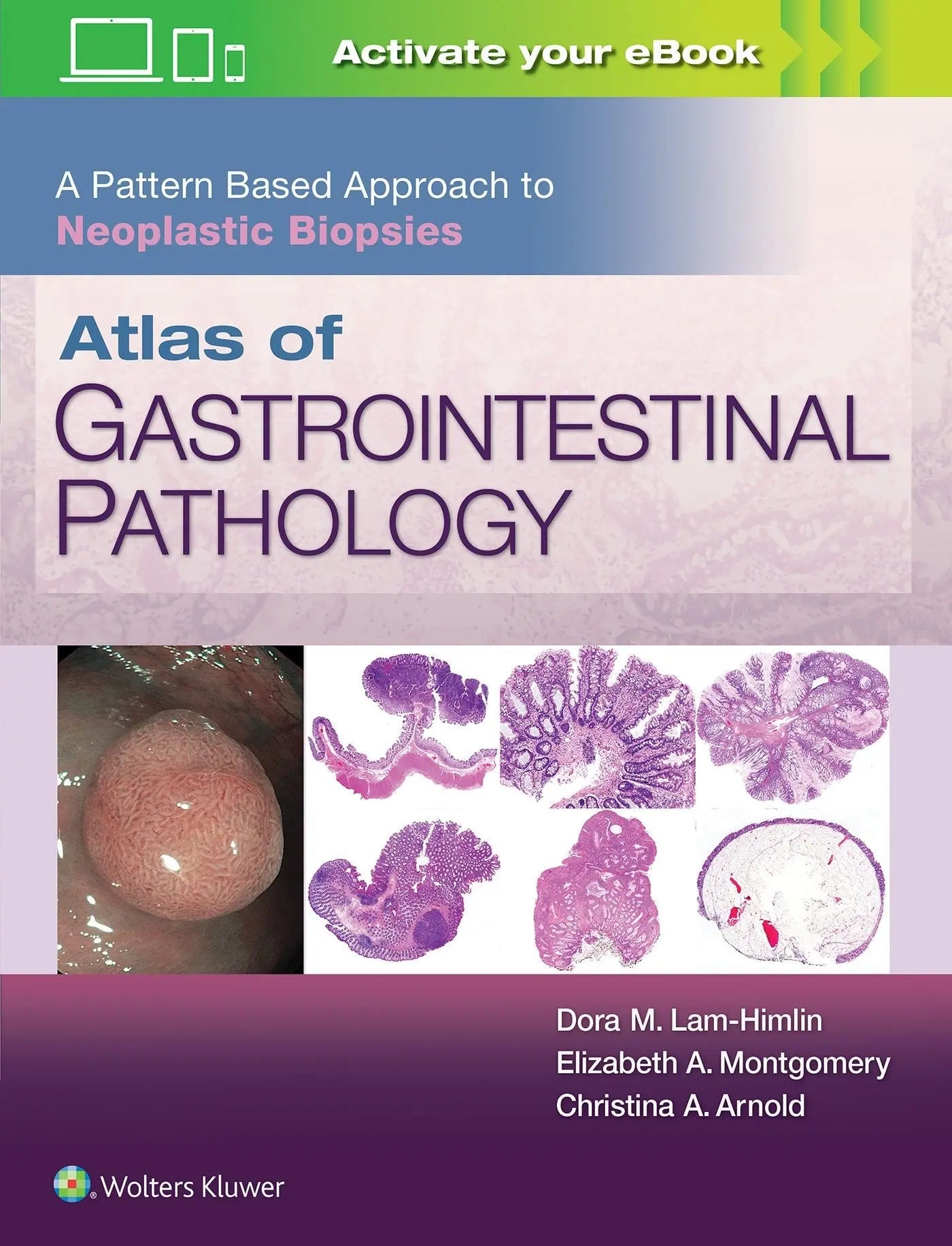 Atlas of Gastrointestinal Pathology A Pattern Based Approach to Neoplastic Biopsies by Dora M. Lam-Himlin – book cover