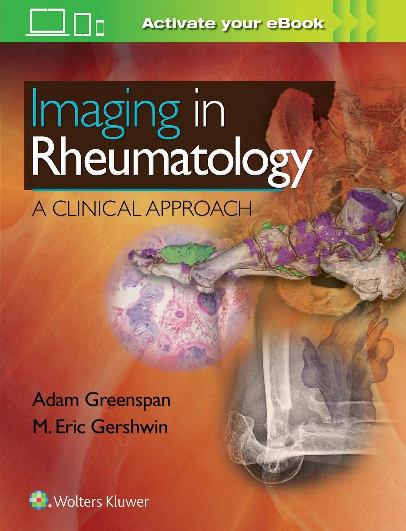 Imaging in Rheumatology A Clinical Approach by Adam Greenspan – book cover