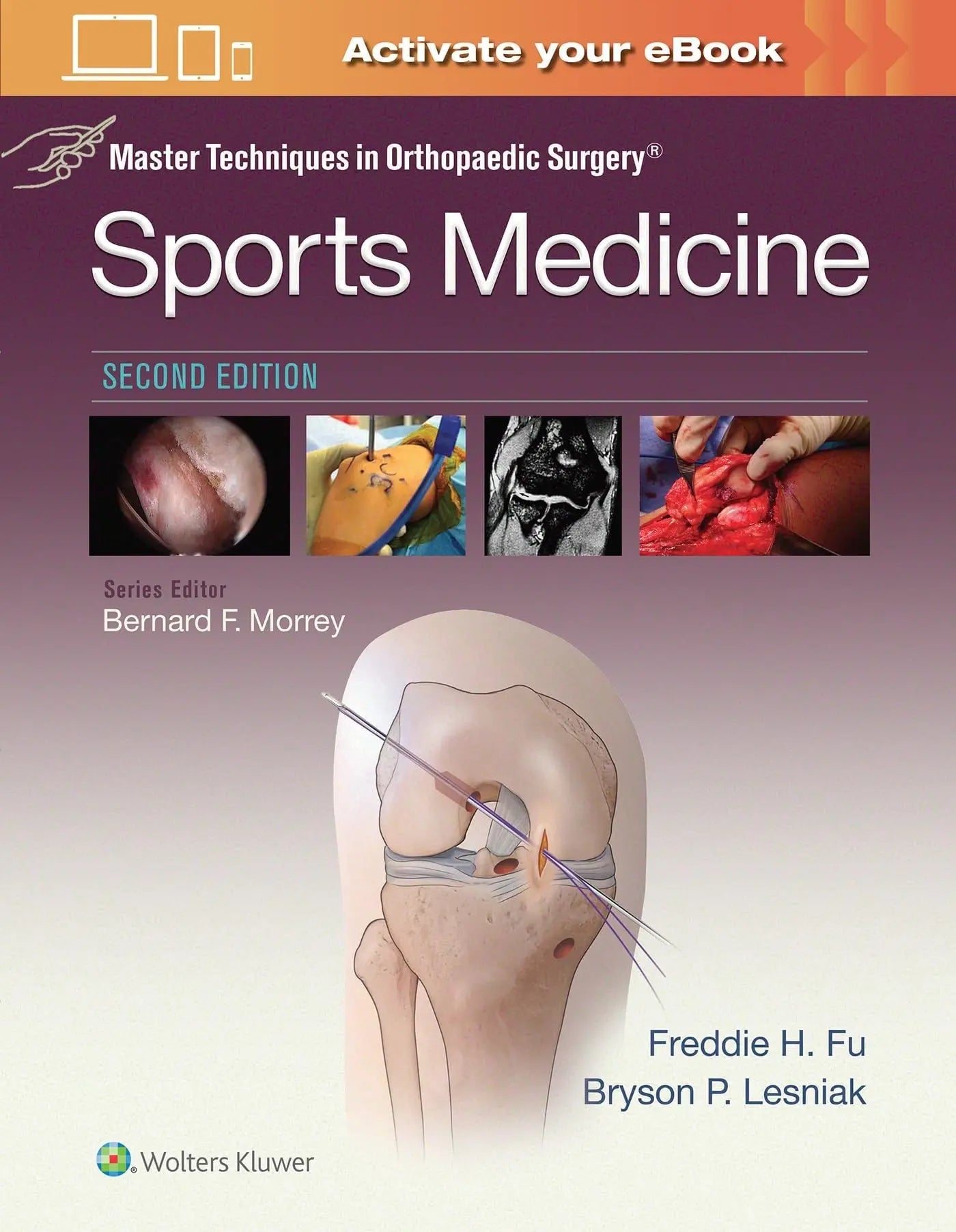 Master Techniques in Orthopaedic Surgery: Sports Medicine by Freddie H. Fu – book cover