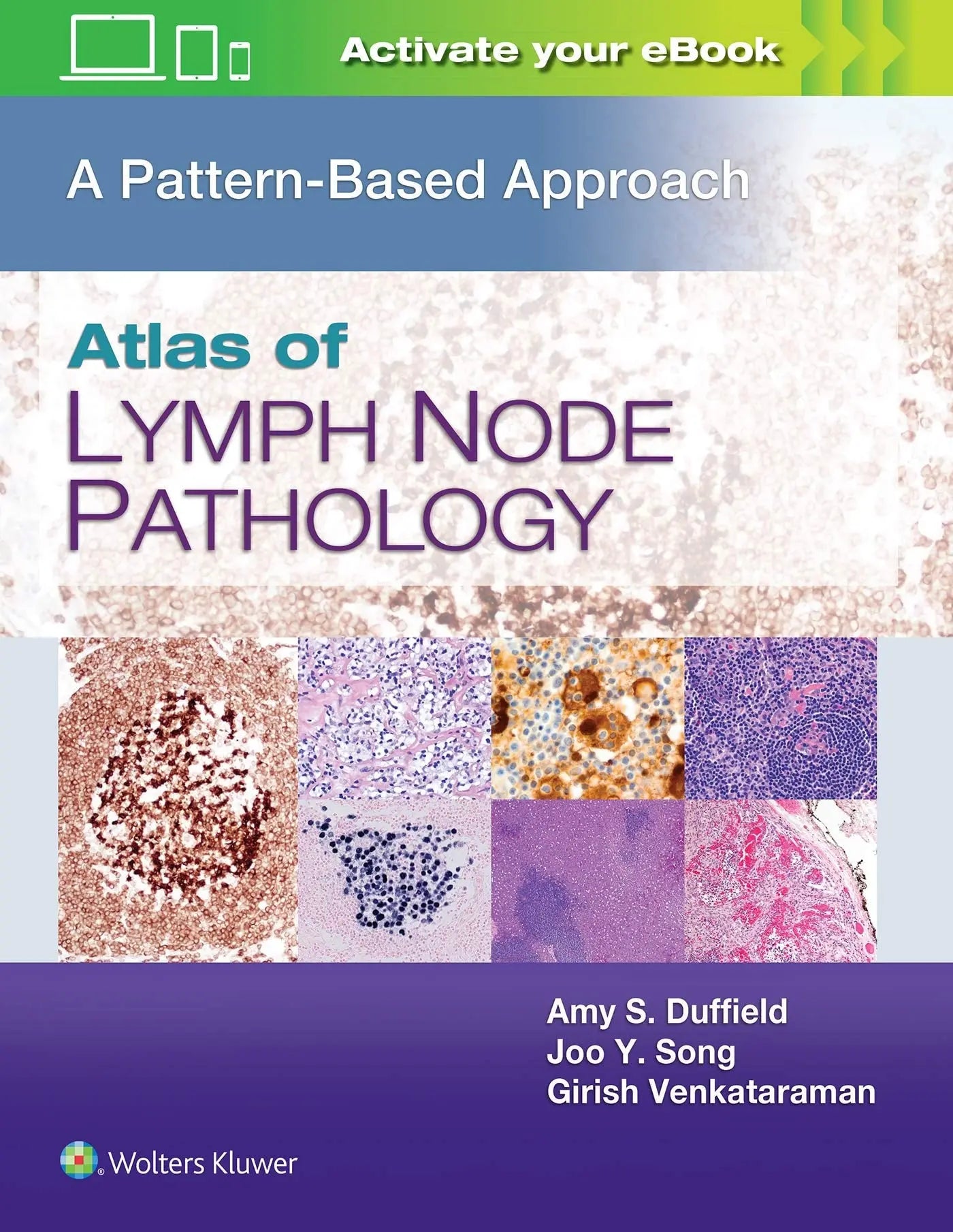 Atlas of Lymph Node Pathology A Pattern Based Approach by Amy S. Duffield – book cover