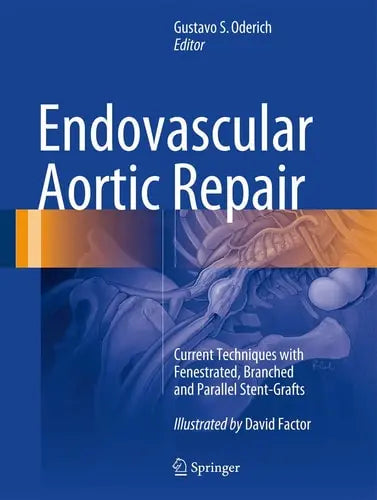 Endovascular Aortic Repair Current Techniques with Fenestrated, Branched and Parallel Stent-Grafts Springer International Publishing