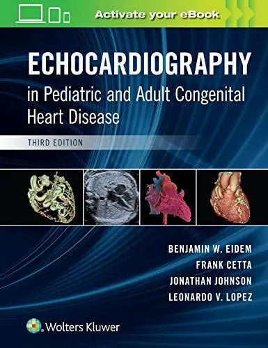 Echocardiography in Pediatric and Adult Congenital Heart Disease by Benjamin W. Eidem – book cover