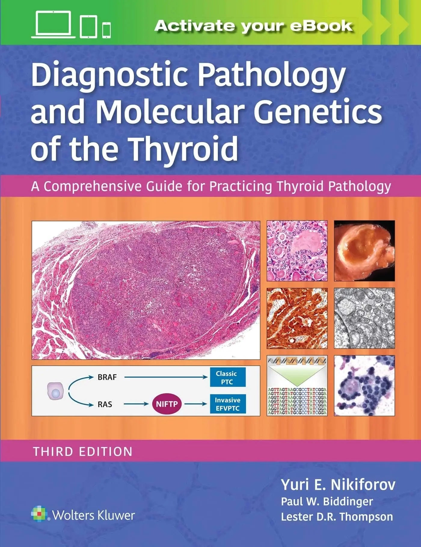 Diagnostic Pathology and Molecular Genetics of the Thyroid A Comprehensive Guide for Practicing Thyroid – book cover