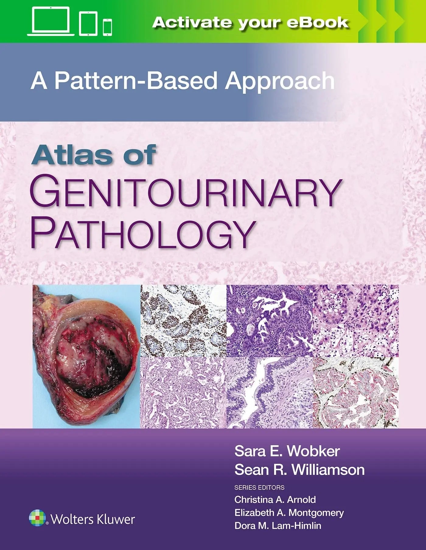 Atlas of Genitourinary Pathology A Pattern Based Approach by Sara E. Wobker – book cover