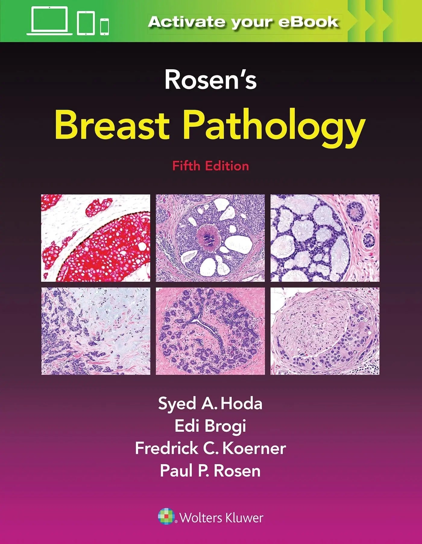 Rosen's Breast Pathology by Syed A. Hoda – book cover