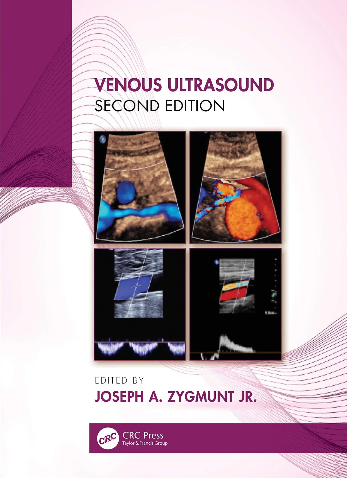 Venous Ultrasound by Joseph Zygmunt – book cover