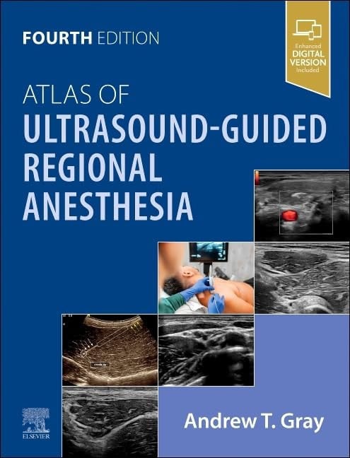 Atlas of Ultrasound-Guided Regional Anesthesia Elsevier