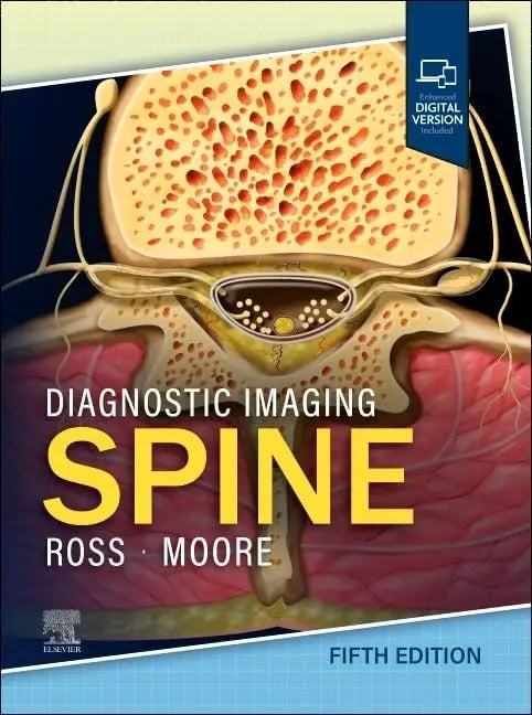 Diagnostic Imaging: Spine by Jeffrey S. Ross – book cover
