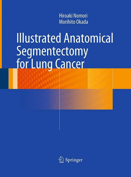 Illustrated Anatomical Segmentectomy for Lung Cancer by Hiroaki Nomori