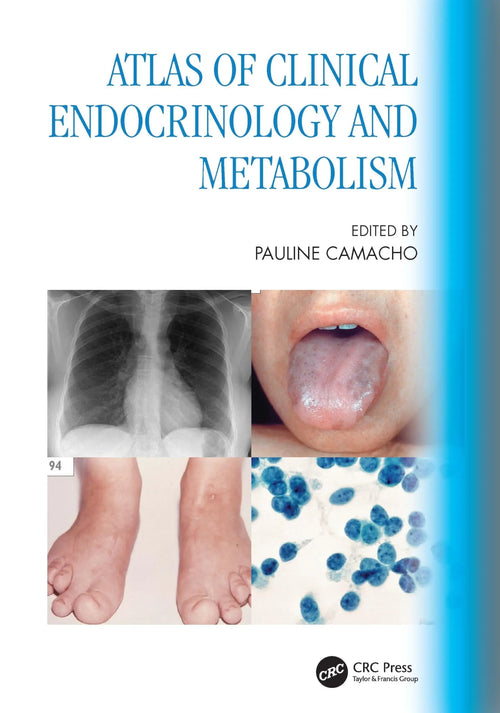 Atlas of Clinical Endocrinology and Metabolism by Pauline Camacho