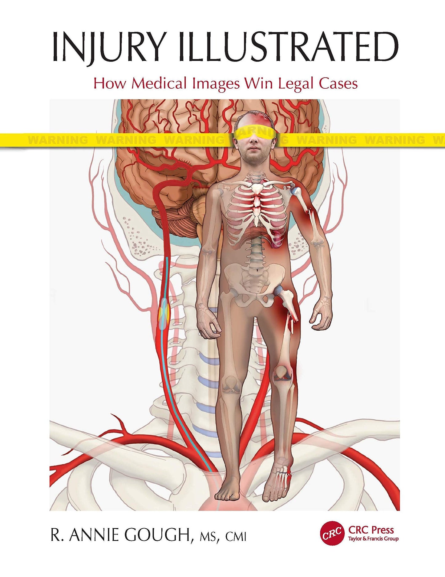 Injury Illustrated How Medical Images Win Legal Cases Taylor & Francis Group
