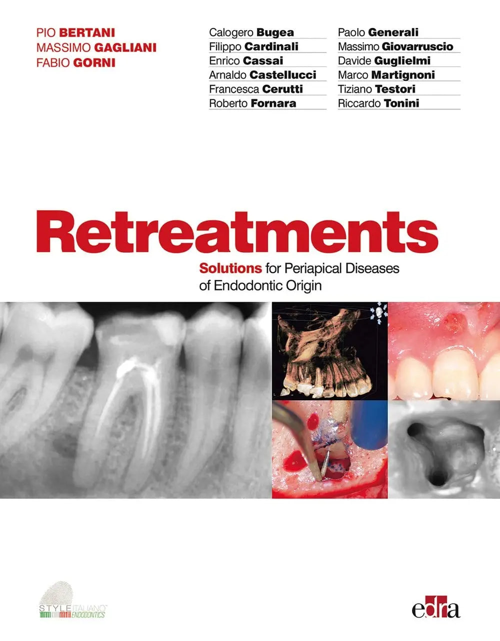Retreatments. Solutions for Periapical Diseases of Endodontic Origin by Pio Bertani – book cover