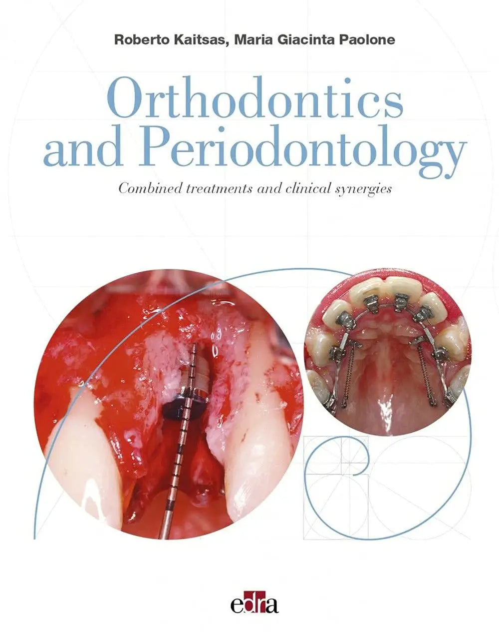 Orthodontics and Periodontology. Combined Treatments and Clinical Synergies by Roberto Kaitsas – book cover