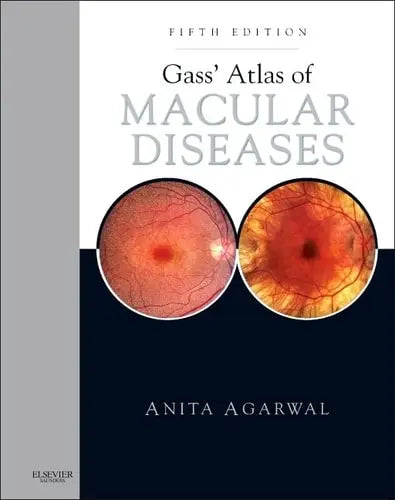 Gass' Atlas of Macular Diseases 2-Volume Set - Expert Consult: Online and Print Elsevier Health Sciences