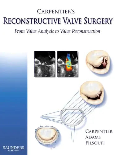 Carpentier's Reconstructive Valve Surgery From Valve Analysis to Valve Reconstruction Saunders/Elsevier