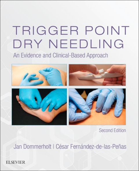 Trigger Point Dry Needling by Jan Dommerholt