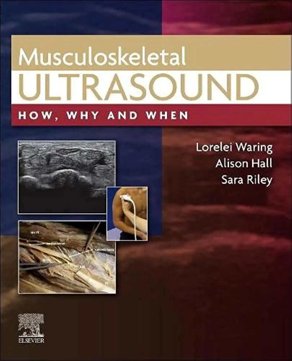 Musculoskeletal Ultrasound How, Why and When by Lorelei Waring – book cover