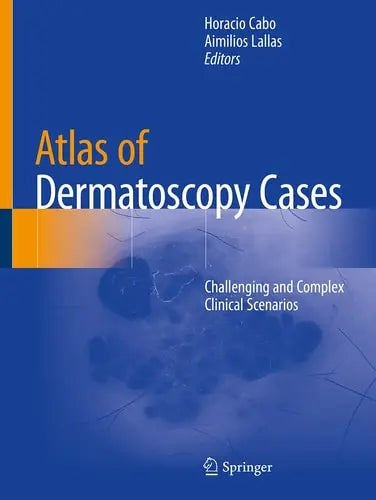 Atlas of Dermatoscopy Cases Challenging and Complex Clinical Scenarios Springer International Publishing