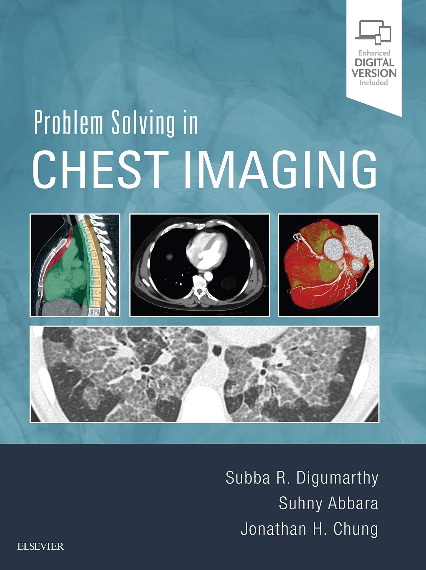 Problem Solving in Chest Imaging by Subba R. Digumarthy – book cover