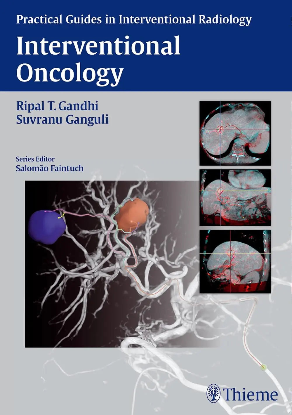 Interventional Oncology by Ripal T. Gandhi – book cover