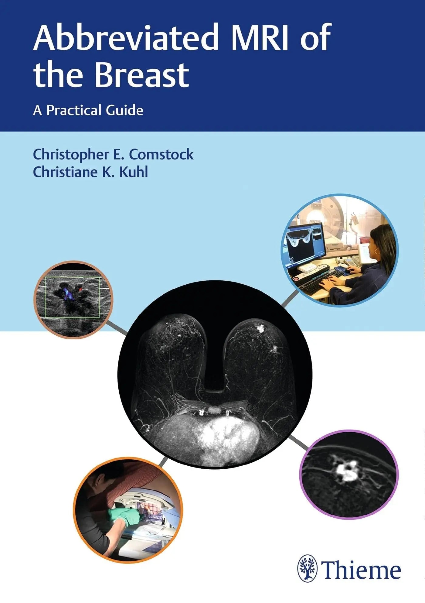 Abbreviated MRI of the Breast A Practical Guide by Christopher E. Comstock – book cover