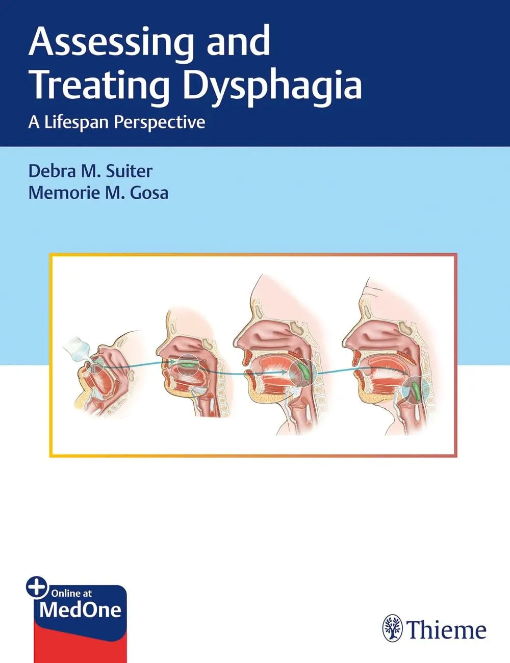 Assessing and Treating Dysphagia A Lifespan Perspective by Debra M. Suiter – book cover