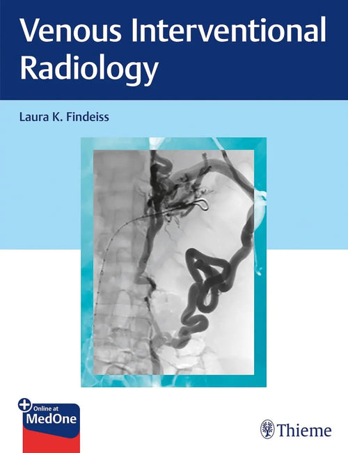 Venous Interventional Radiology by Laura K. Findeiss