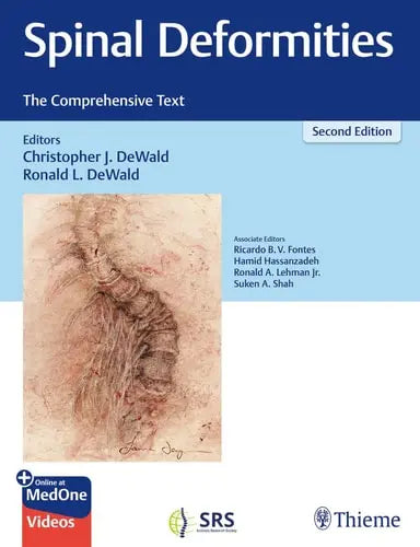 Spinal Deformities The Comprehensive Text Thieme Medical Publishers