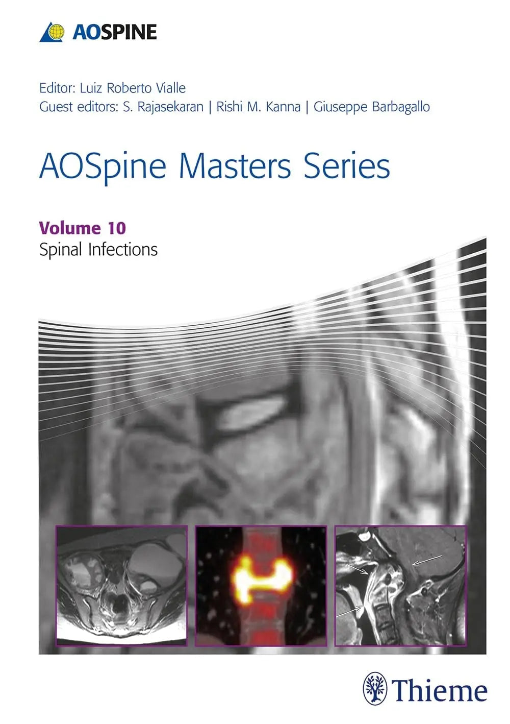 AOSpine Masters Series, Volume 10: Spinal Infections by Luiz Roberto Vialle – book cover