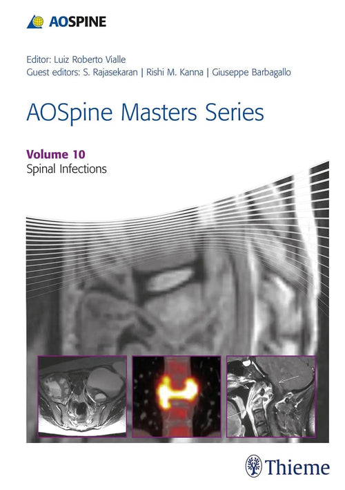 AOSpine Masters Series, Volume 10: Spinal Infections by Luiz Roberto Vialle