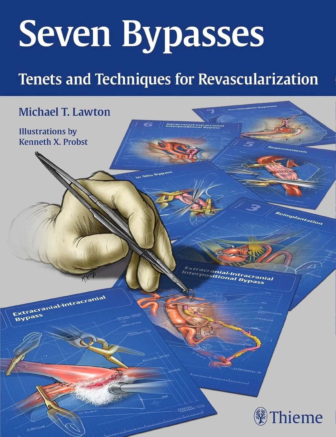 Seven Bypasses Tenets and Techniques for Revascularization by Michael T. Lawton – book cover