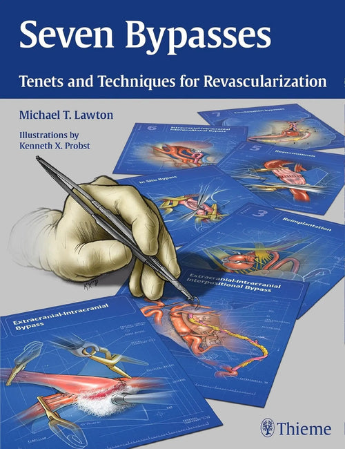 Seven Bypasses Tenets and Techniques for Revascularization by Michael T. Lawton