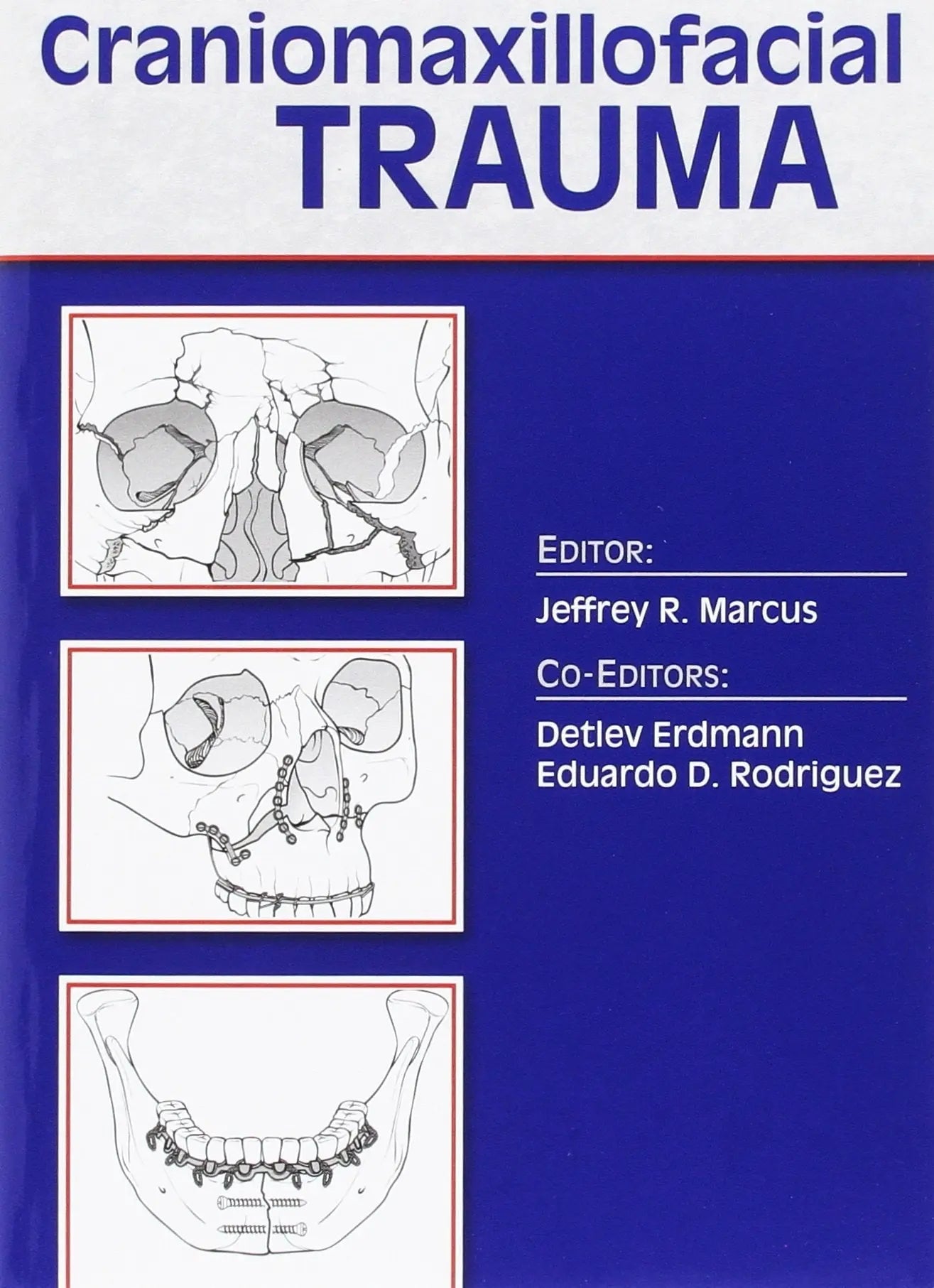 Essentials of Craniomaxillofacial Trauma by Jeffrey Marcus – book cover