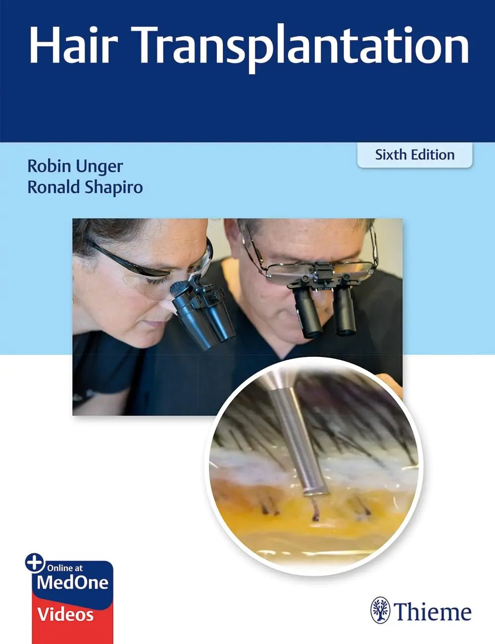 Hair Transplantation by Robin Unger – book cover