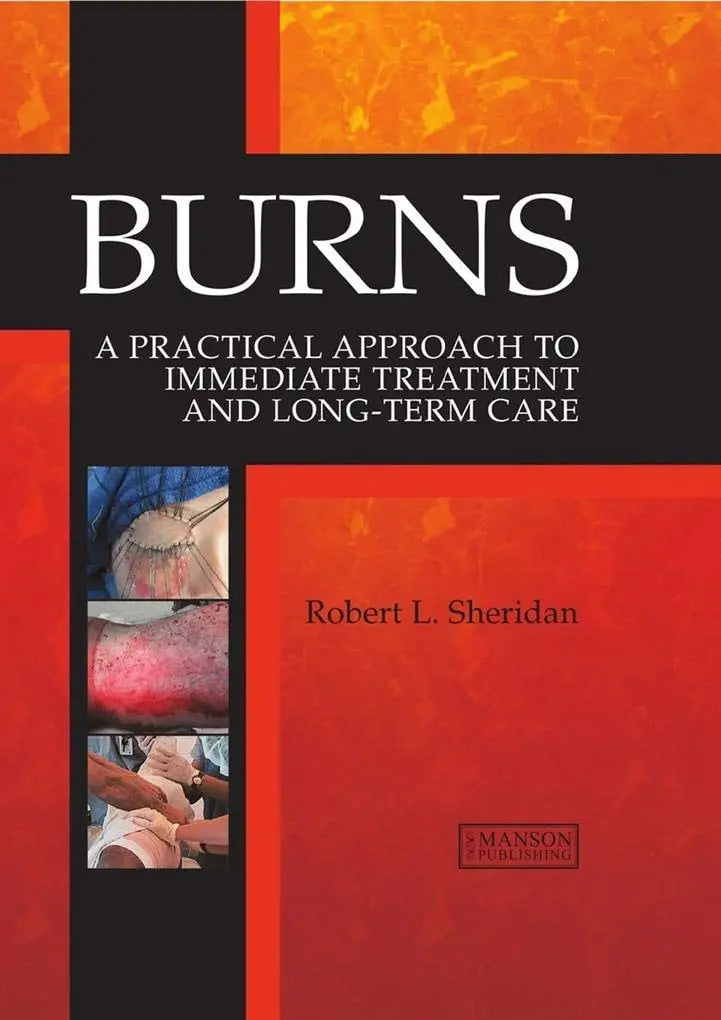 Burns A Practical Approach to Immediate Treatment and Long-Term Care by Robert Sheridan – book cover