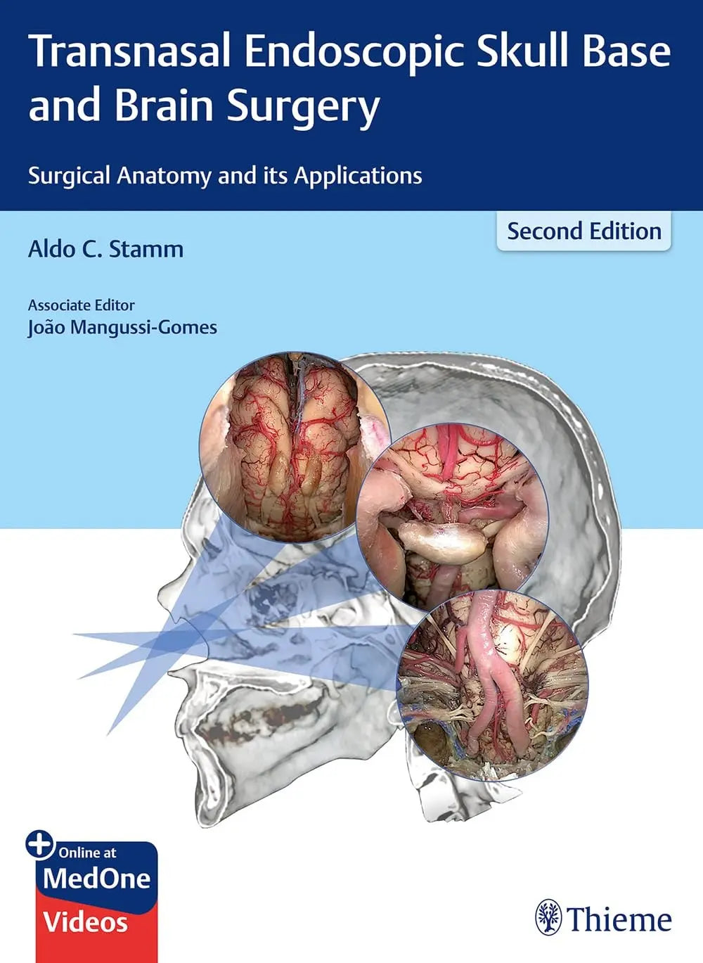Transnasal Endoscopic Skull Base and Brain Surgery Surgical Anatomy and Its Applications by Aldo C. Stamm – book cover