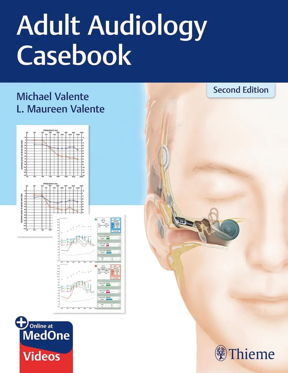 Adult Audiology Casebook by Michael Valente – book cover