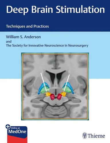 Deep Brain Stimulation Techniques and Practices Thieme