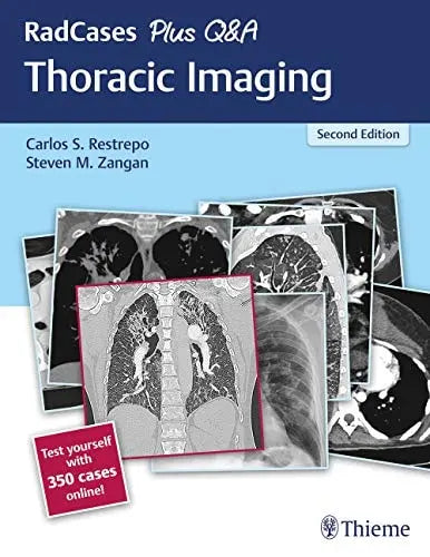 RadCases Plus Q&A Thoracic Imaging by Carlos Santiago Restrepo – book cover