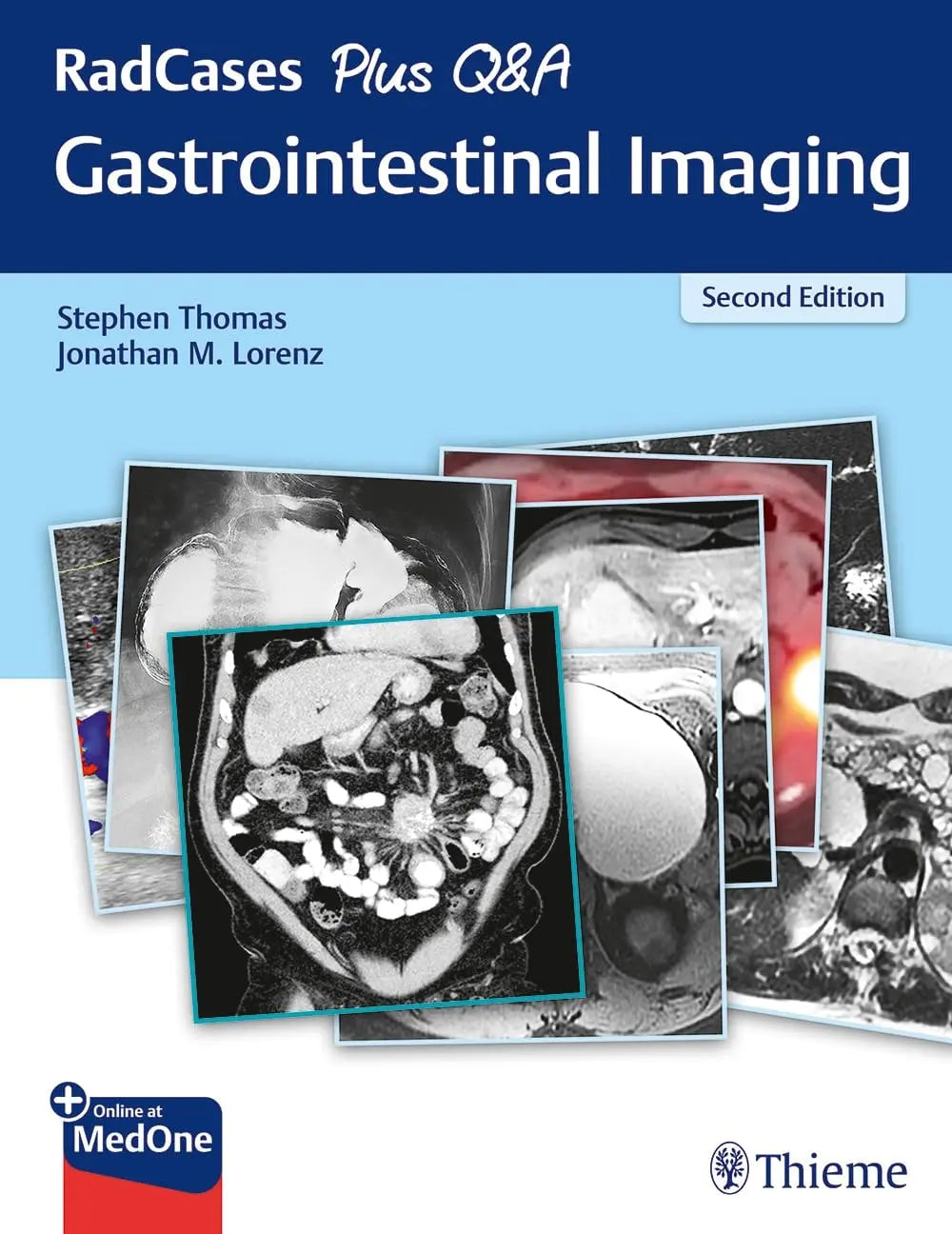 RadCases Gastrointestinal Imaging by Stephen Thomas – book cover