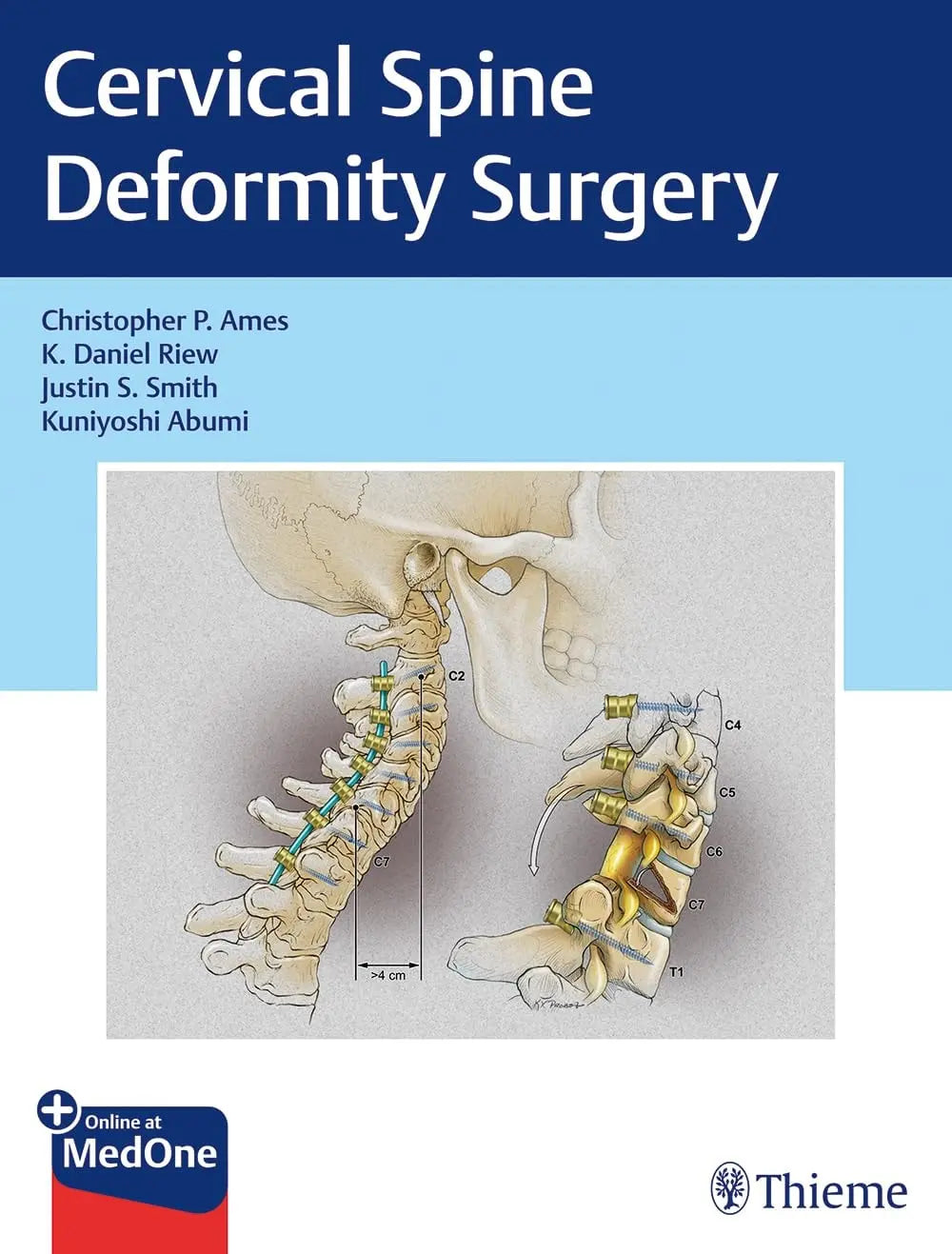 Cervical Spine Deformity Surgery by Christopher P. Ames – book cover