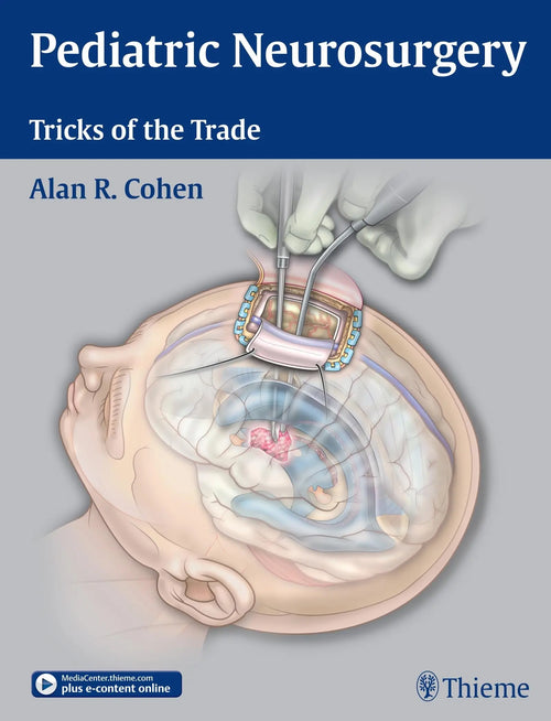 Pediatric Neurosurgery Tricks of the Trade by Alan R. Cohen