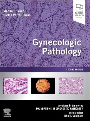 Gynecologic Pathology A Volume in Foundations in Diagnostic Pathology Series