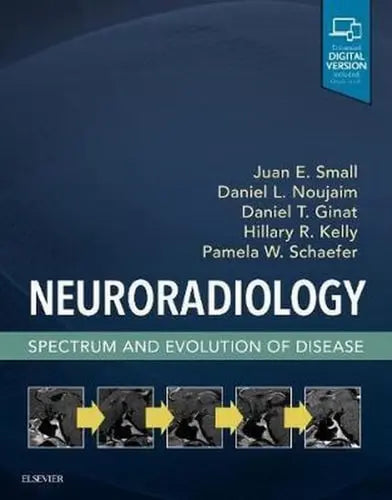 Neuroradiology: Spectrum and Evolution of Disease Elsevier