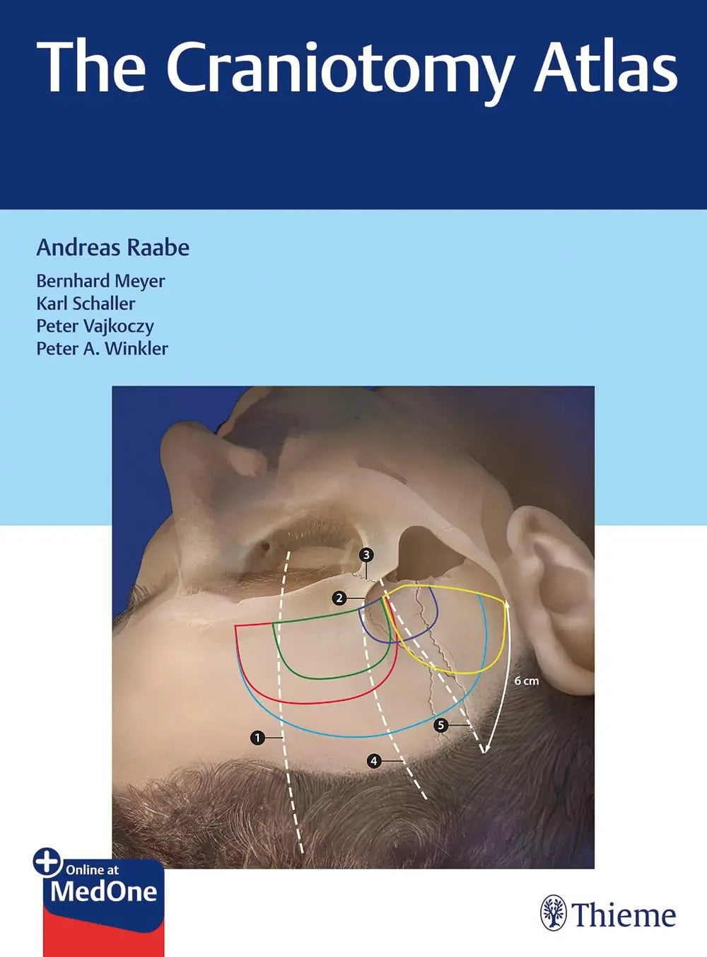 The Craniotomy Atlas by Andreas Raabe – book cover