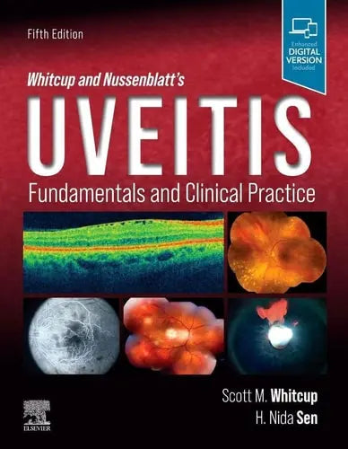 Whitcup and Nussenblatt's Uveitis Fundamentals and Clinical Practice Elsevier