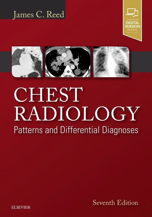 Chest Radiology Patterns and Differential Diagnoses by James C. Reed
