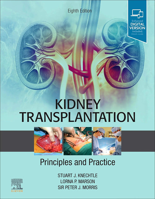 Kidney Transplantation Principles and Practice by Stuart J. Knechtle